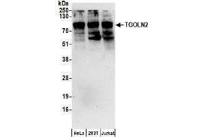 Western Blotting (WB) image for anti-Trans-Golgi Network Protein 2 (TGOLN2) (AA 175-225) antibody (ABIN7455035)