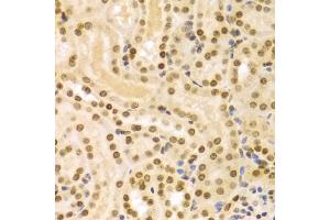 Immunohistochemistry of paraffin-embedded mouse kidney using DKC1 Antibody (ABIN5970956) at dilution of 1/100 (40x lens). (DKC1 Antikörper)