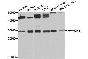 Western blot analysis of extracts of various cell lines, using HAVCR2 antibody. (TIM3 Antikörper)