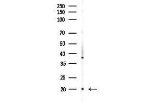 Western blot analysis of lysates from HUVEC cells(starvation,24h treatment), using C19orf10 Antibody at 1/1000 dilution.