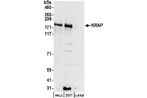 anti-Sperm Specific Antigen 2 (SSFA2) (AA 1209-1259) antibody