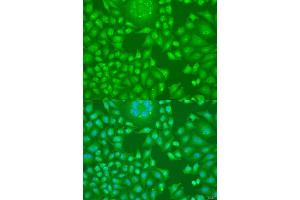 Immunofluorescence analysis of U2OS cells using CCND2 antibody (ABIN1875413) at dilution of 1:100. (Cyclin D2 Antikörper)