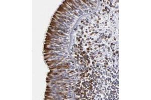 Immunohistochemical staining of human nasopharynx with CEP97 polyclonal antibody  shows strong cytoplasmic positivity in respiratory epithelial cells at 1:200-1:500 dilution. (CEP97 Antikörper)
