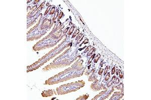 IHC analysis of EIF4A using anti-EIF4A antibody (ABIN7601309). (EIF4A1 Antikörper  (AA 32-406))