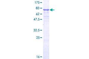 Vitamin D Receptor Protein (VDR) (AA 1-427) (GST tag)