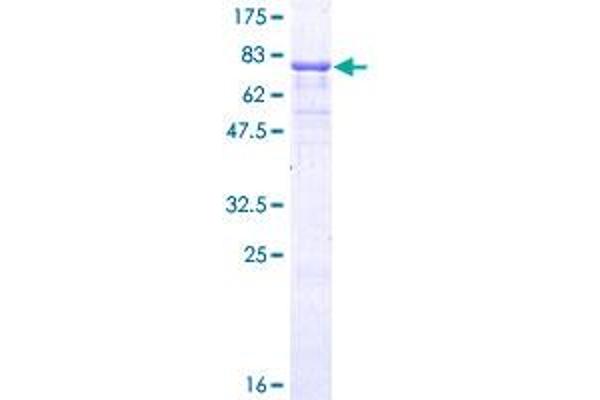 Vitamin D Receptor Protein (VDR) (AA 1-427) (GST tag)