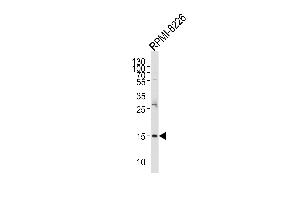 Western blot analysis of lysate from RI-8226 cell line, using REG3A Antibody (N-term) (ABIN653158 and ABIN2842726).