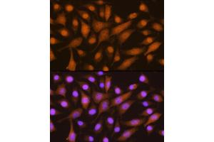 Immunofluorescence analysis of L929 cells using SKP2 Rabbit pAb (ABIN6134430, ABIN6147822, ABIN6147824 and ABIN6223665) at dilution of 1:100. (SKP2 Antikörper  (AA 1-100))