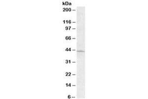 Western blot testing of HeLa lysate with ARPC1A antibody at 0. (ARPC1A Antikörper)