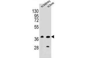 Western Blotting (WB) image for anti-CUGBP, Elav-Like Family Member 6 (CELF6) antibody (ABIN2996337) (CELF6 Antikörper)