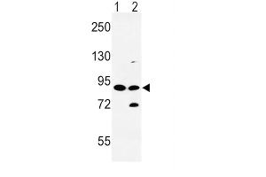 Western Blotting (WB) image for anti-Solute Carrier Family 8 (Sodium/calcium Exchanger), Member 1 (SLC8A1) antibody (ABIN3003974) (SLC8A1 Antikörper)