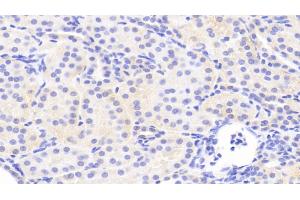 Detection of JNK1 in Human Kidney Tissue using Polyclonal Antibody to c-Jun N-terminal Kinase 1 (JNK1) (C-Jun N-Terminal Kinases (AA 145-419) Antikörper)