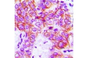 Immunohistochemistry (IHC) image for anti-PTK2 Protein tyrosine Kinase 2 (PTK2) (C-Term) antibody (ABIN7302990)