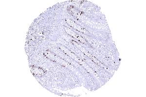 anti-Topoisomerase (DNA) II alpha 170kDa (TOP2A) (AA 1352-1493) antibody