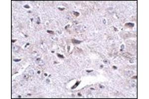 Immunohistochemistry (Paraffin-embedded Sections) (IHC (p)) image for anti-Leucine Rich Repeat and Fibronectin Type III Domain Containing 3 (LRFN3) (Center) antibody (ABIN500190)