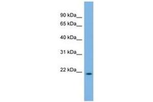 Image no. 1 for anti-DCMP Deaminase (DCTD) (C-Term) antibody (ABIN6743596) (DCMP Deaminase (DCTD) (C-Term) Antikörper)