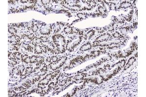 IHC analysis of nmt55/p54nrb using anti-nmt55/p54nrb antibody (ABIN3044530). (NONO Antikörper  (N-Term))