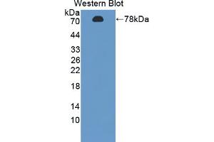 Western blot analysis of the recombinant protein. (FDPS Antikörper  (AA 1-419))