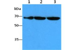 The Cell lysates (40ug) were resolved by SDS-PAGE, transferred to PVDF membrane and probed with anti-human FUBP1 antibody (1:1000). (FUBP1 Antikörper)