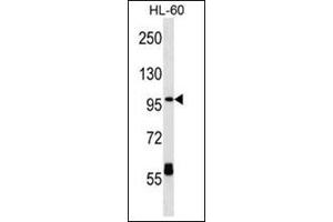 Western blot analysis of CPT1C Antibody (C-term) Cat. (CPT1C Antikörper  (C-Term))