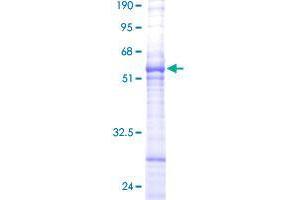 ARL6IP1 Protein (AA 1-203) (GST tag)
