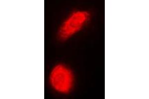 Immunofluorescent analysis of DAXX staining in HeLa cells. (DAXX Antikörper  (Center))