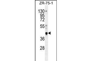 PYGO1 Antibody (C-term) (ABIN656121 and ABIN2845460) western blot analysis in ZR-75-1 cell line lysates (35 μg/lane). (PYGO1 Antikörper  (C-Term))