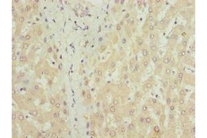 Immunohistochemistry of paraffin-embedded human liver tissue using ABIN7149150 at dilution of 1:100 (COX17 Antikörper  (AA 1-63))