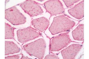 Immunohistochemistry (Paraffin-embedded Sections) (IHC (p)) image for anti-Transcription Elongation Factor B (SIII), Polypeptide 1 (15kDa, Elongin C) (TCEB1) antibody (FITC) (ABIN2571257)