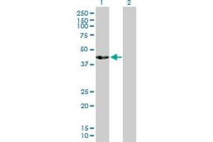 Western Blot analysis of ACTL7B expression in transfected 293T cell line by ACTL7B MaxPab polyclonal antibody. (Actl7b Antikörper  (AA 1-415))