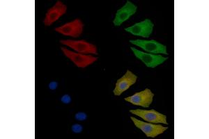 CaMKII alpha Mouse Monoclonal Antibody staining Hela cells by IF/ICC. (CAMK2A Antikörper)