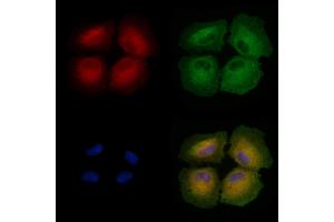 ABIN6258498 and ABIN6274470 staining  cells by IF/ICC. (ORCTL-2/SLC22A18 Antikörper  (C-Term))