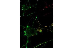 Live cell imaging of Tertiapin-Q-ATTO Fluor-633 in differentiated  cells. (Tertiapin Q peptide (Atto 633))