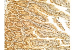 ABIN6256411 and ABIN6267503 at 1/100 staining Rat colon tissue by IHC-P.