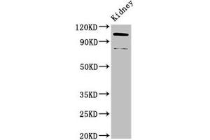 Western Blot Positive WB detected in: Mouse kidney tissue All lanes: ACTN4 antibody at 3. (alpha Actinin 4 Antikörper  (AA 6-277))