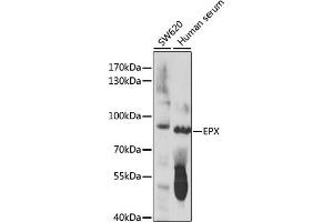 Western blot analysis of extracts of various cell lines, using EPX antibody (ABIN7266966) at 1:1000 dilution. (EPX Antikörper  (AA 400-500))
