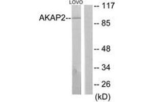 Western Blotting (WB) image for anti-A Kinase (PRKA) Anchor Protein 2 (AKAP2) (AA 71-120) antibody (ABIN2889820) (AKAP2 Antikörper  (AA 71-120))