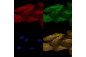 anti-Vesicle-Associated Membrane Protein 4 (VAMP4) (N-Term) antibody