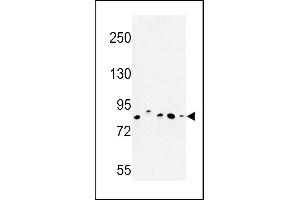 Western blot analysis of CHPF Antibody (Center) (ABIN652988 and ABIN2842628) in MDA-M, MCF-7, HepG2,  cell line and mouse testis tissue lysates (35 μg/lane). (CHPF Antikörper  (AA 327-354))
