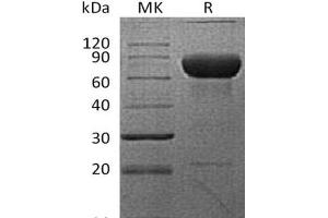 Western Blotting (WB) image for Programmed Cell Death 1 Ligand 2 (PDCD1LG2) protein (Fc Tag) (ABIN7320964) (PDCD1LG2 Protein (Fc Tag))