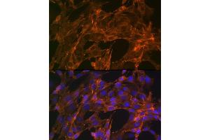 Immunofluorescence analysis of NIH-3T3 cells using α-Actinin-4 Rabbit mAb (ABIN7265399) at dilution of 1:100 (40x lens).
