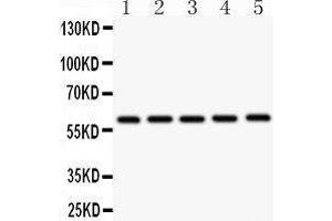 Western Blotting (WB) image for anti-Cystathionine-beta-Synthase (CBS) (AA 331-551) antibody (ABIN3043747)
