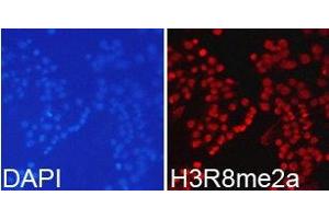 Immunofluorescence analysis of 293T cell using H3R8me2a antibody. (Histone 3 Antikörper  (H3R8me2a))