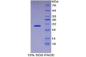 SDS-PAGE (SDS) image for Leukemia Inhibitory Factor Receptor alpha (LIFR) (AA 522-691) protein (His tag) (ABIN1980768)