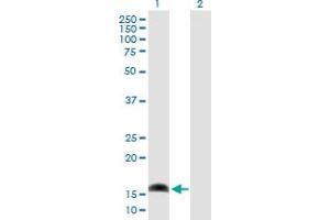 Western Blot analysis of AP1S1 expression in transfected 293T cell line by AP1S1 MaxPab polyclonal antibody.