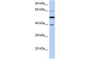 Image no. 1 for anti-Paraneoplastic Antigen MA3 (PNMA3) (AA 71-120) antibody (ABIN6743786) (PNMA3 Antikörper  (AA 71-120))