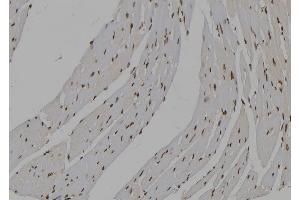 ABIN6277535 at 1/100 staining Mouse heart tissue by IHC-P. (IMPDH2 Antikörper  (Internal Region))