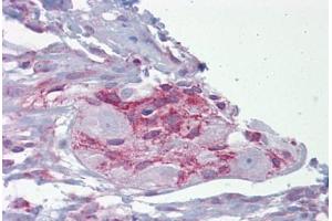 Anti-ASPH antibody IHC staining of human small intestine and myenteric plexus. (Aspartate beta Hydroxylase Antikörper  (AA 107-156))