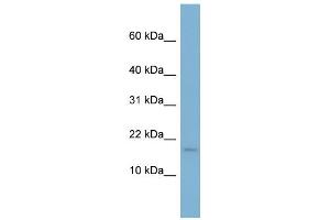 WB Suggested Anti-RPS13 Antibody Titration: 0. (RPS13 Antikörper  (N-Term))