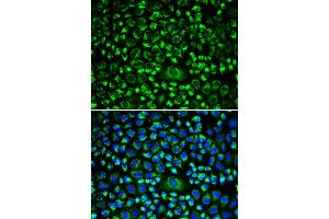 Immunofluorescence analysis of HeLa cells using TAPBP antibody. (TAPBP Antikörper)